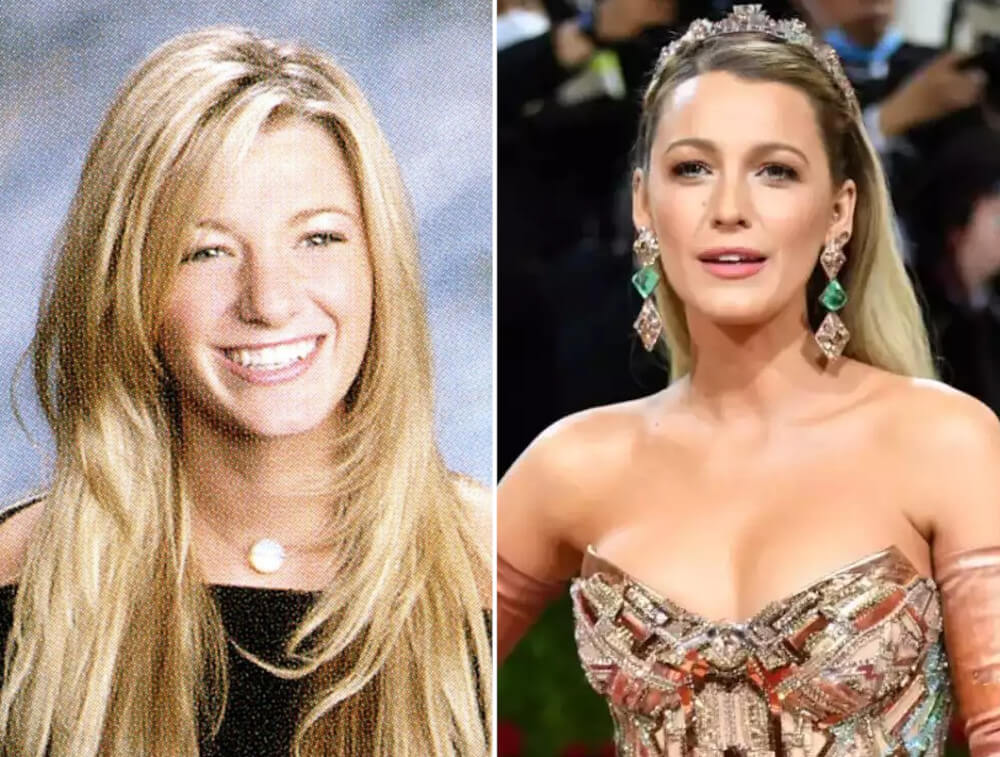 Blake Lively nose job then and now
