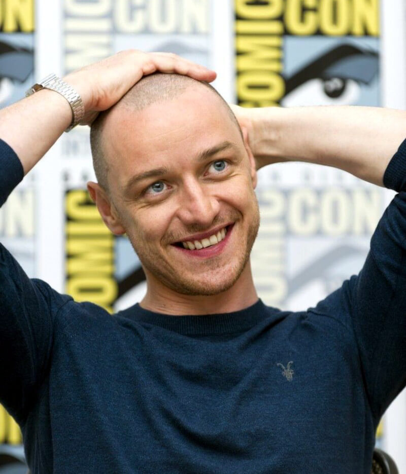 James McAvoy bald