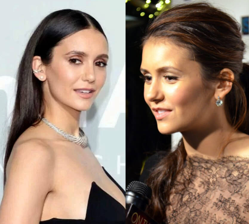 Nina Dobrev plastic surgery before and after
