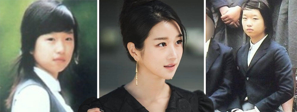 Seo Ye-Ji young photo, plastic surgery